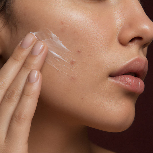 Best Acne Treatment in Dubai: What Actually Works for Clearer Skin?