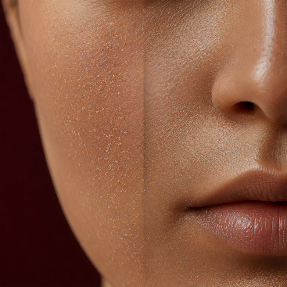 Dehydrated Skin vs Dry Skin: How to Tell the Difference and Fix It
